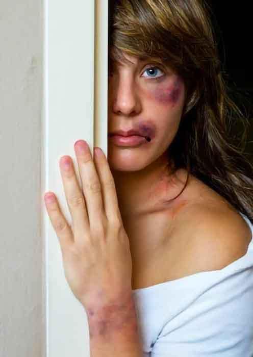 Primo piano di una donna ferita con segni di violenza sul viso, simbolo di femminicidio e violenza sulle donne.